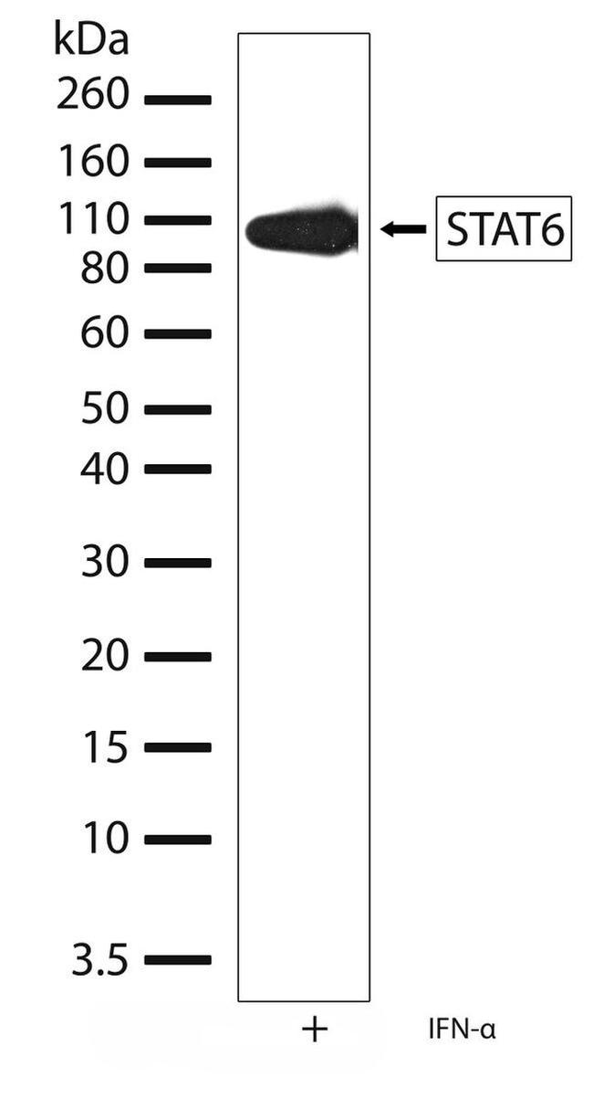 STAT6 Antibody in Western Blot (WB)