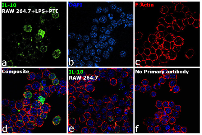 IL-10 Antibody in Immunocytochemistry (ICC/IF)