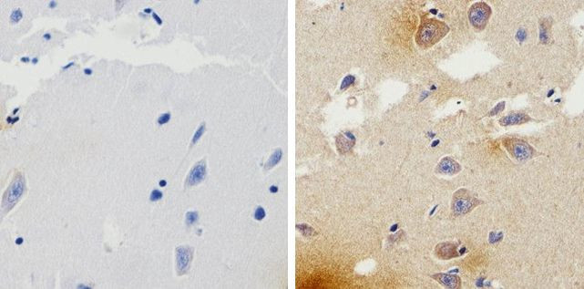 beta Amyloid Antibody in Immunohistochemistry (Paraffin) (IHC (P))