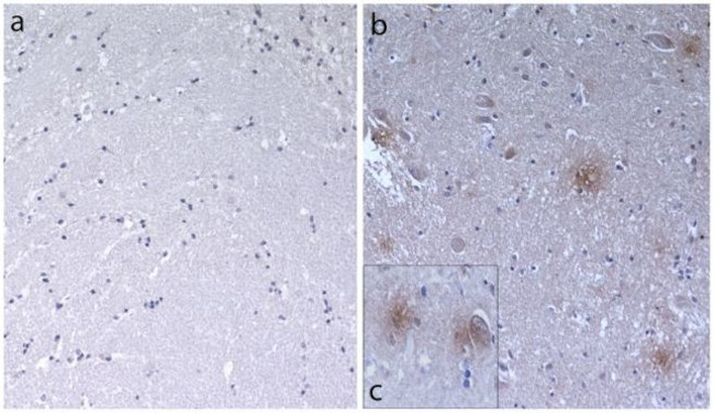 beta Amyloid Antibody in Immunohistochemistry (IHC)