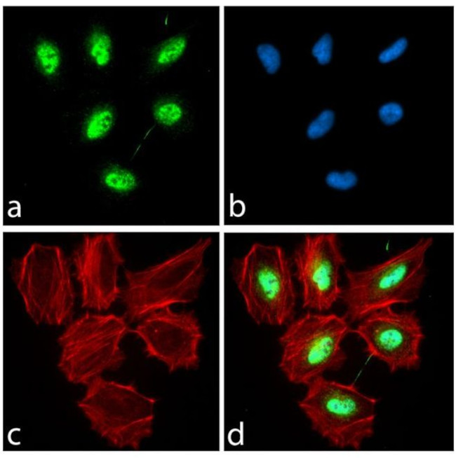 PAX3 Antibody in Immunocytochemistry (ICC/IF)