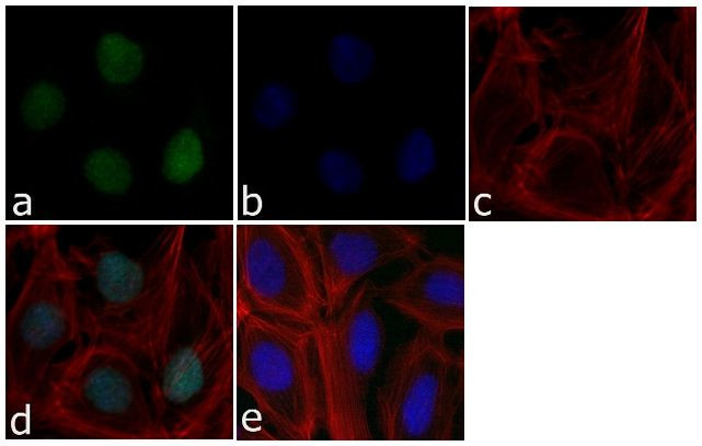 p21 Antibody in Immunocytochemistry (ICC/IF)