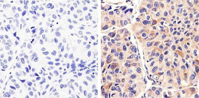 Syndecan 2 Antibody in Immunohistochemistry (Paraffin) (IHC (P))