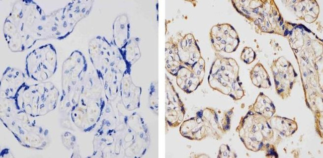 TLR4 Antibody in Immunohistochemistry (Paraffin) (IHC (P))