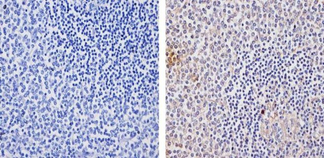 TLR4 Antibody in Immunohistochemistry (Paraffin) (IHC (P))