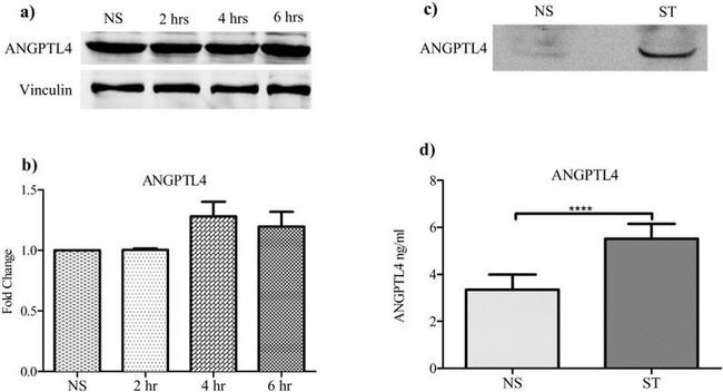 ANGPTL4 Antibody in Western Blot (WB)