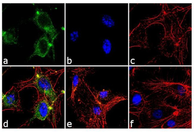 ANGPTL4 Antibody in Immunocytochemistry (ICC/IF)