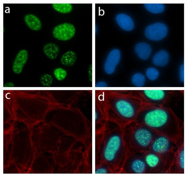 LMO2 Antibody in Immunocytochemistry (ICC/IF)