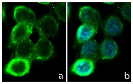 Occludin Antibody in Immunocytochemistry (ICC/IF)