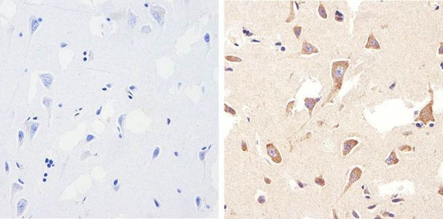 Occludin Antibody in Immunohistochemistry (Paraffin) (IHC (P))