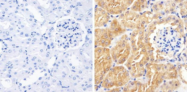 Occludin Antibody in Immunohistochemistry (Paraffin) (IHC (P))