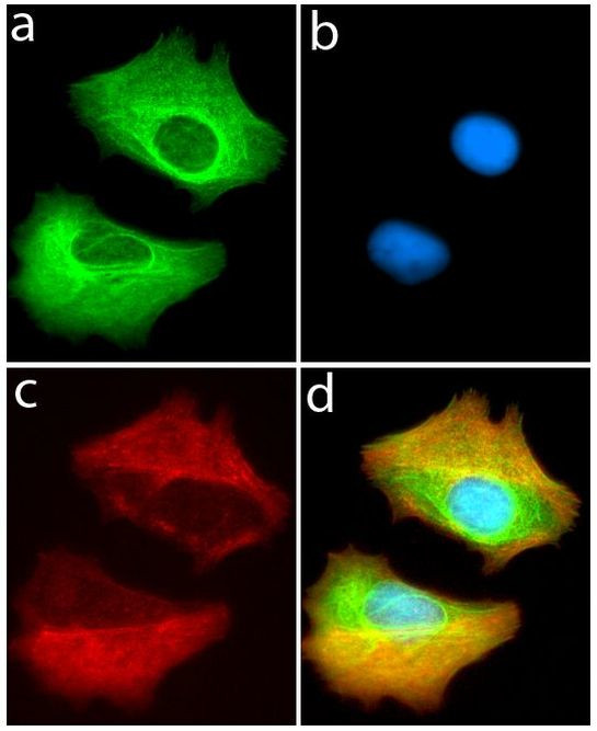 VPS34 Antibody in Immunocytochemistry (ICC/IF)