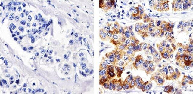 Metadherin Antibody in Immunohistochemistry (Paraffin) (IHC (P))