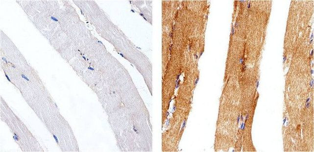 Metadherin Antibody in Immunohistochemistry (Paraffin) (IHC (P))