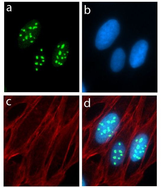 Metadherin Antibody in Immunocytochemistry (ICC/IF)