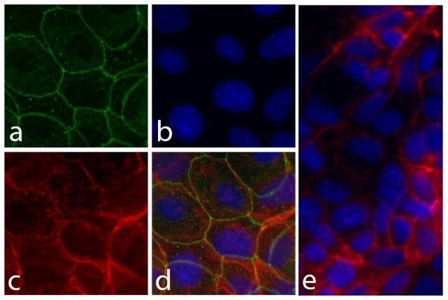 CD49f Antibody in Immunocytochemistry (ICC/IF)