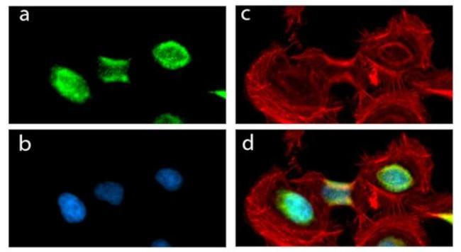 PITX3 Antibody in Immunocytochemistry (ICC/IF)