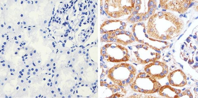 Claudin 16 Antibody in Immunohistochemistry (Paraffin) (IHC (P))