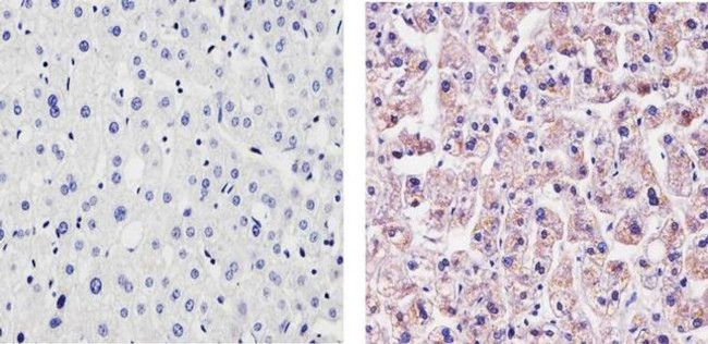 CRP Antibody in Immunohistochemistry (Paraffin) (IHC (P))