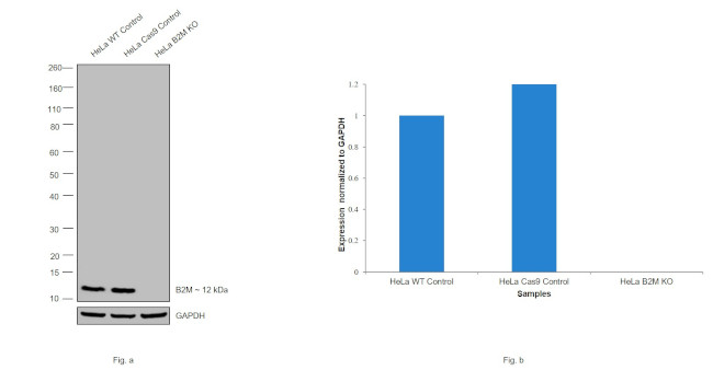 beta-2 Microglobulin Antibody