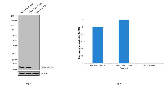 beta-2 Microglobulin Antibody in Western Blot (WB)