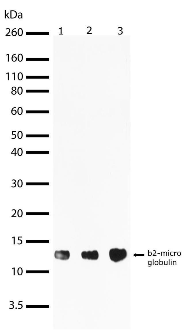 beta-2 Microglobulin Antibody in Western Blot (WB)