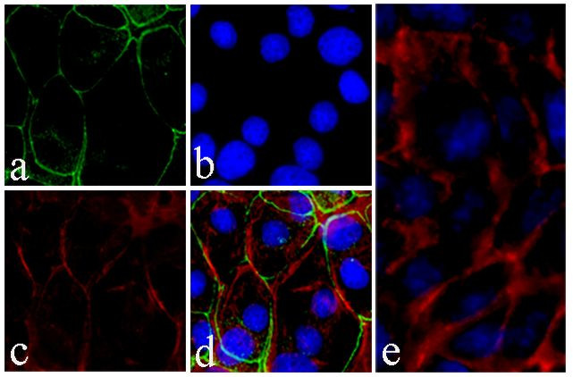 ICAM-1 Antibody in Immunocytochemistry (ICC/IF)