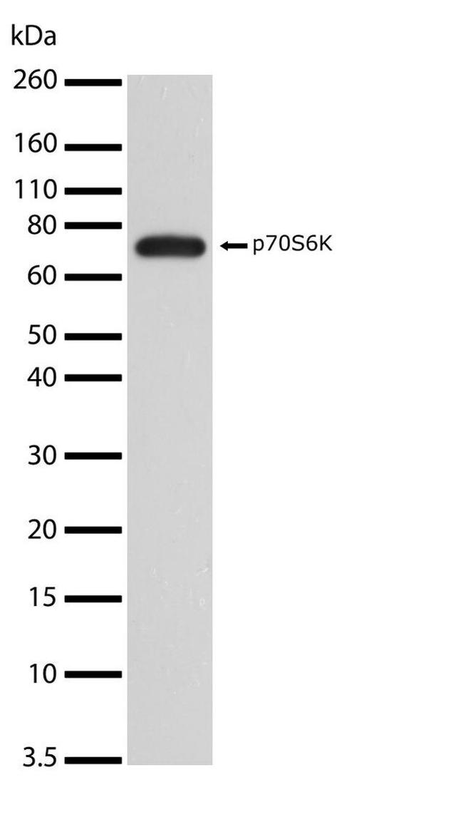 p70 S6 Kinase Antibody in Western Blot (WB)