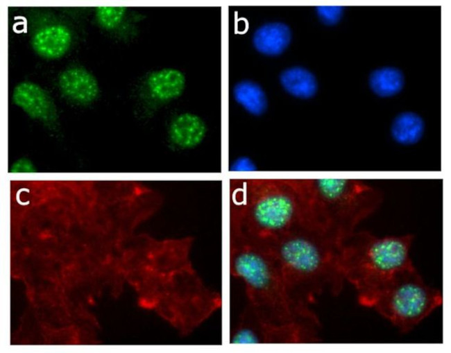 Phospho-EIF2S1 (Ser51) Antibody in Immunocytochemistry (ICC/IF)