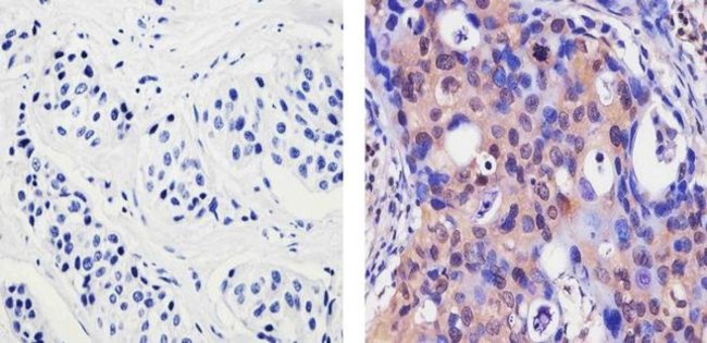 Acetyl-p53 (Lys382) Antibody in Immunohistochemistry (Paraffin) (IHC (P))