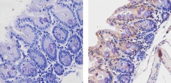 Acetyl-p53 (Lys382) Antibody in Immunohistochemistry (Paraffin) (IHC (P))