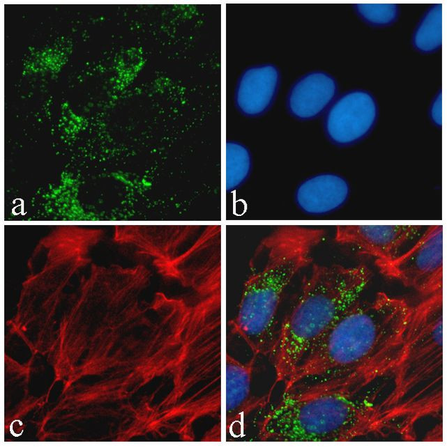 Phospho-Tau (Ser396) Antibody in Immunocytochemistry (ICC/IF)