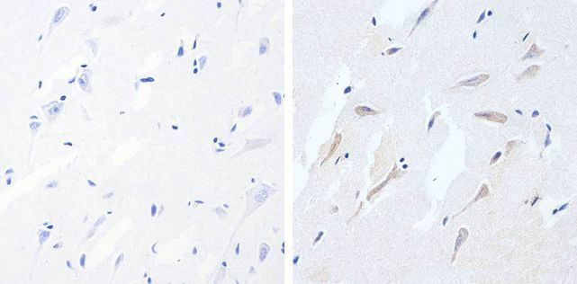 Phospho-Tau (Ser396) Antibody in Immunohistochemistry (Paraffin) (IHC (P))