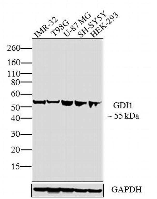 GDI1 Antibody in Western Blot (WB)