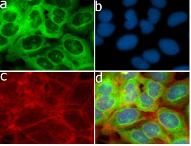 MMP13 Antibody in Immunocytochemistry (ICC/IF)