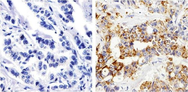 MMP13 Antibody in Immunohistochemistry (Paraffin) (IHC (P))