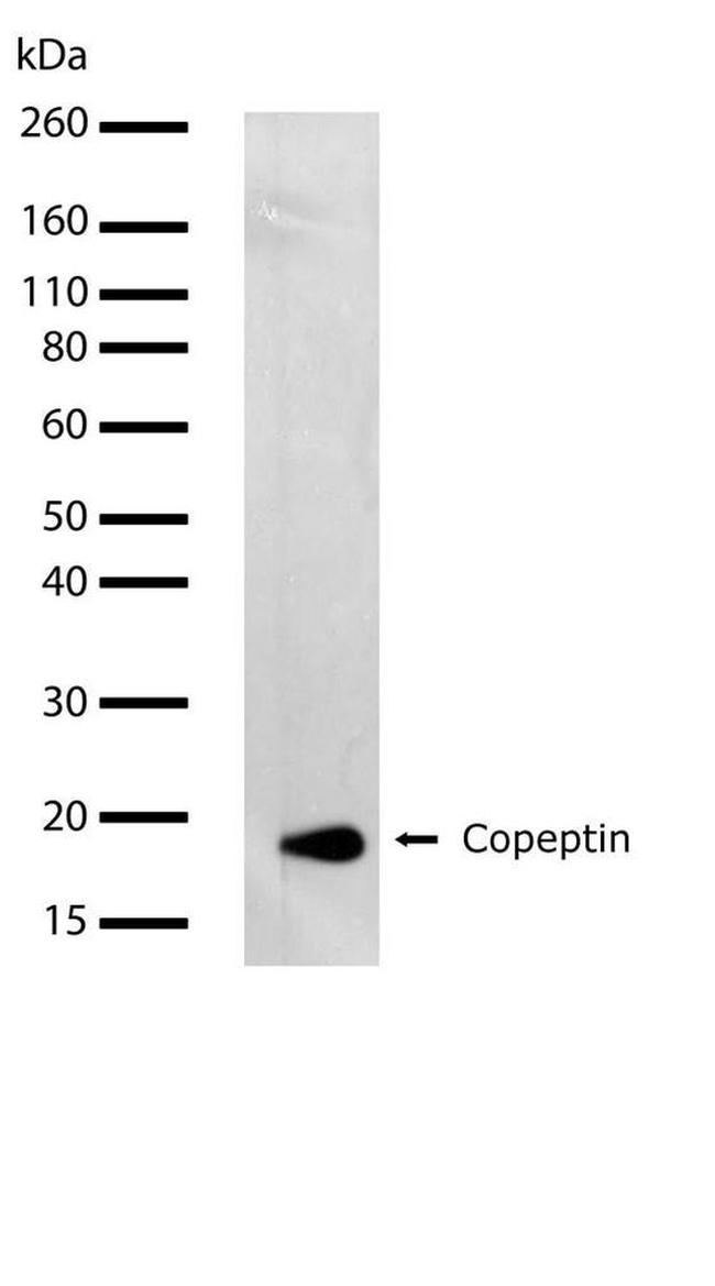 Copeptin Antibody in Western Blot (WB)