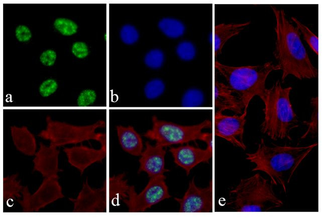 Phospho-4EBP1 (Thr46) Antibody in Immunocytochemistry (ICC/IF)