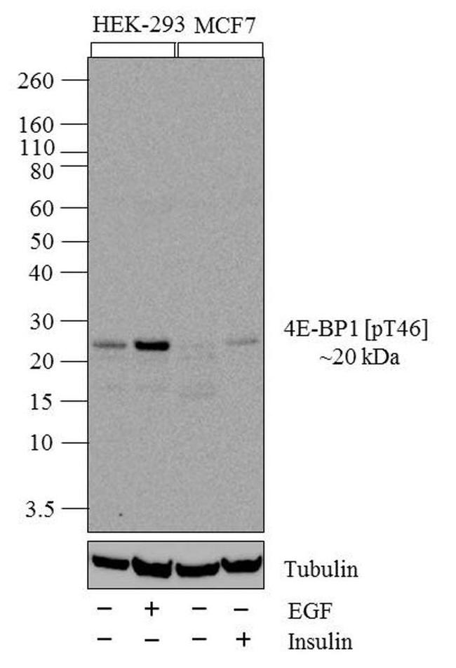 Phospho-4EBP1 (Thr46) Antibody in Western Blot (WB)