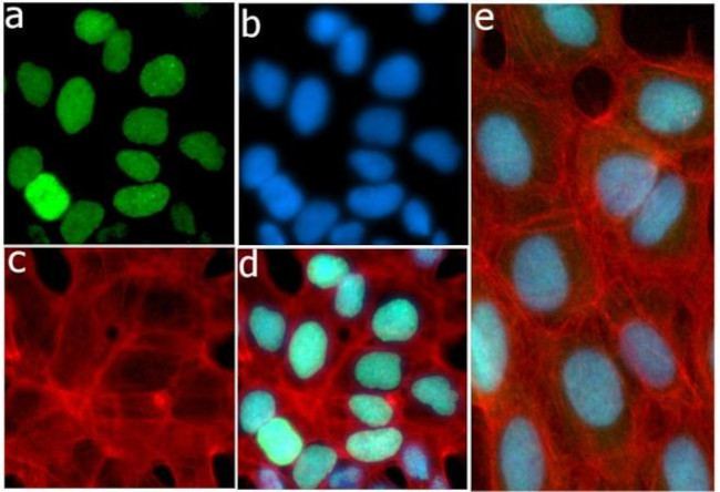 Phospho-4EBP1 (Thr46) Antibody in Immunocytochemistry (ICC/IF)