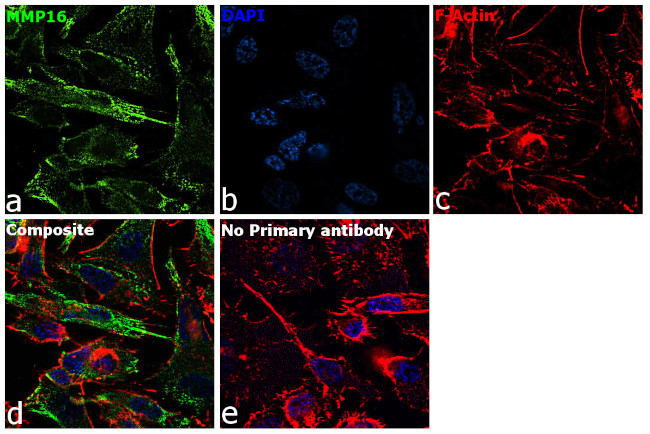 MMP16 Antibody in Immunocytochemistry (ICC/IF)