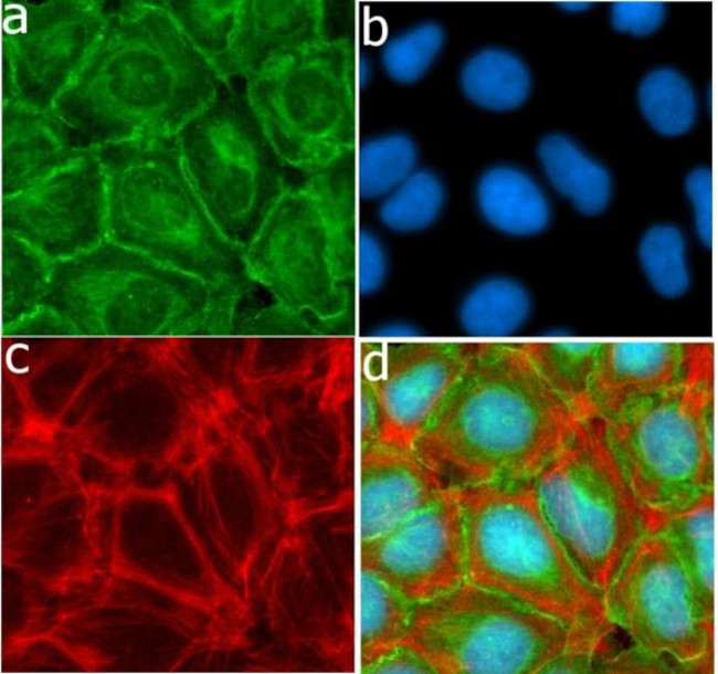 MMP16 Antibody in Immunocytochemistry (ICC/IF)