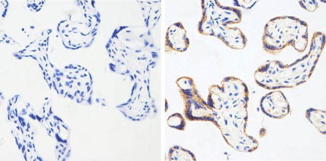 MMP16 Antibody in Immunohistochemistry (Paraffin) (IHC (P))