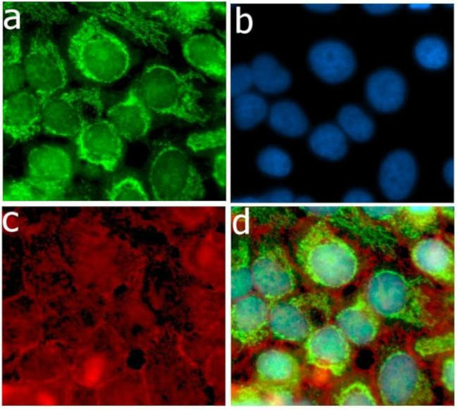 Ubiquitin Antibody in Immunocytochemistry (ICC/IF)