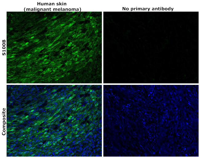 S100B Antibody in Immunohistochemistry (Paraffin) (IHC (P))