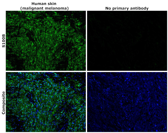 S100B Antibody in Immunohistochemistry (Paraffin) (IHC (P))