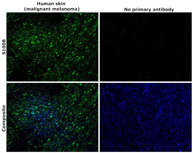 S100B Antibody in Immunohistochemistry (Paraffin) (IHC (P))