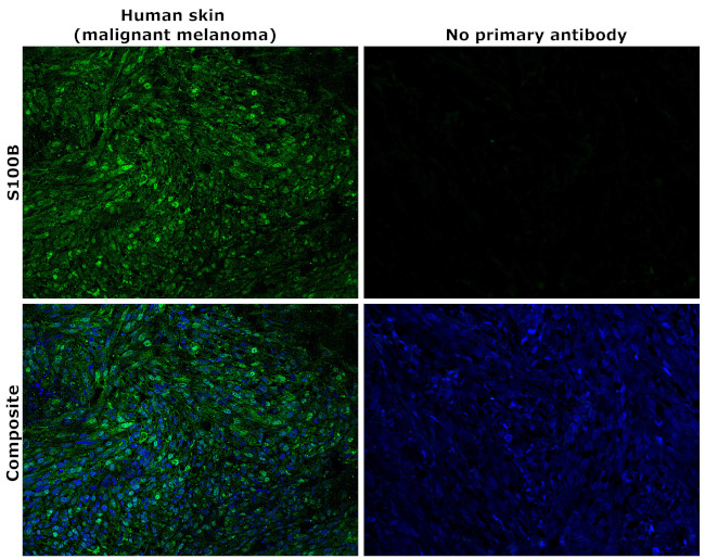 S100B Antibody in Immunohistochemistry (Paraffin) (IHC (P))