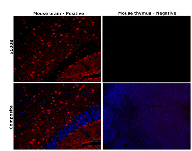 S100B Antibody in Immunohistochemistry (Paraffin) (IHC (P))