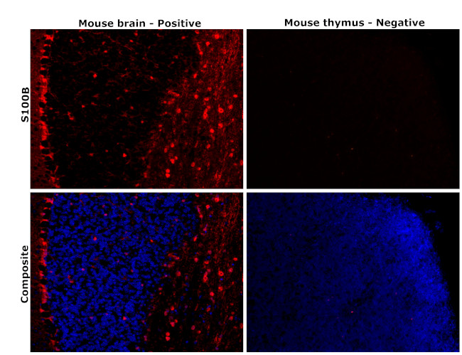 S100B Antibody in Immunohistochemistry (Paraffin) (IHC (P))